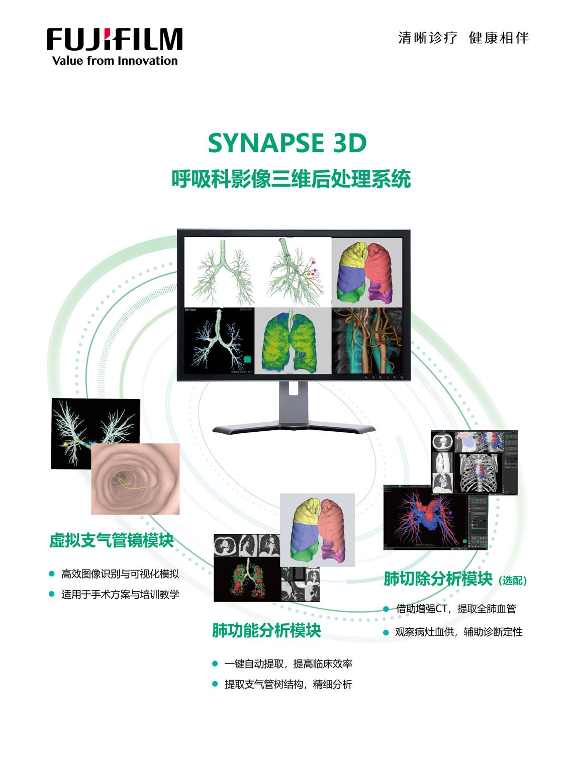 SYNAPSE 3D呼吸科影像三维后处理系统