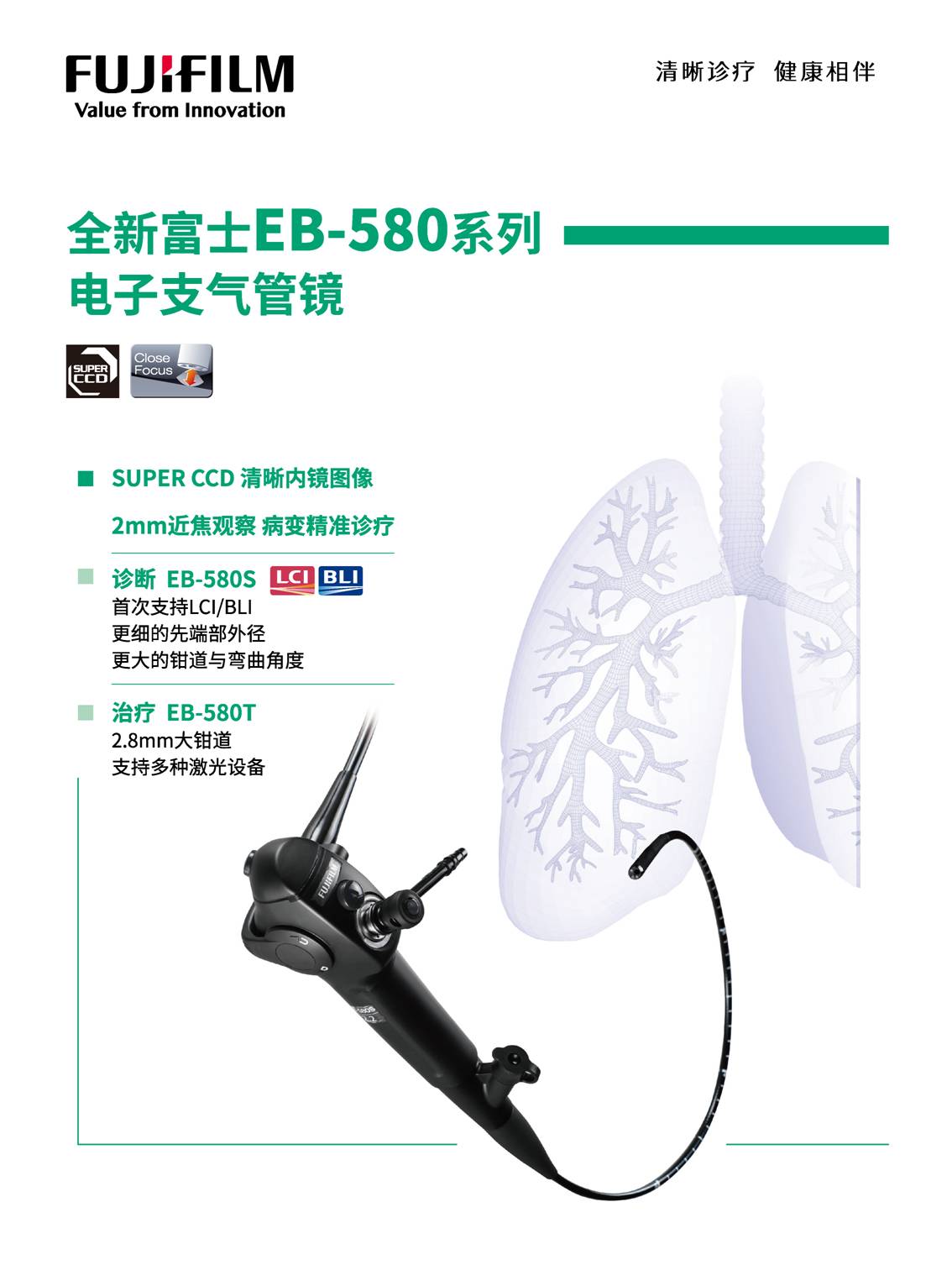 一探究“镜” 自由呼吸 ——黄陂区中医医院最新引进的电子支气管镜投入使用